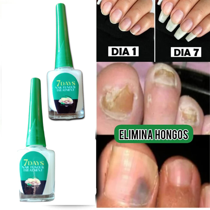 (Compra 1+1 Gratis) Endurecedor De Uñas- 7 Days Nails